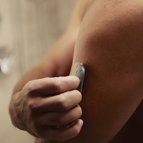 Man removing glucose monitor on arm with a CGM transmitter. 