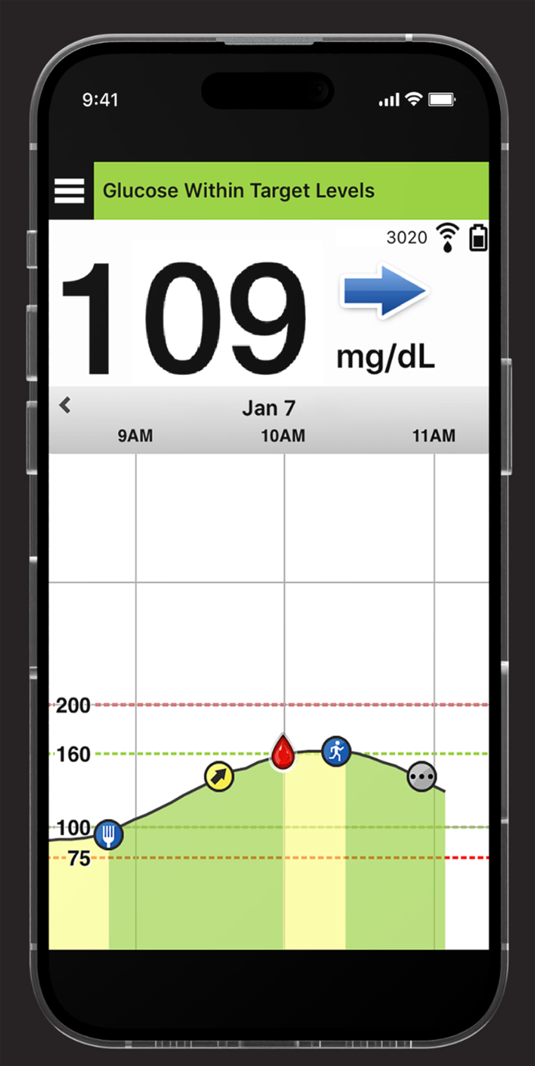 6 Months CGM Eversense® E3 Continuous Glucose Monitoring System