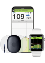 Eversense 365